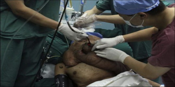 زشت ترین بیمار دنیا + عکس